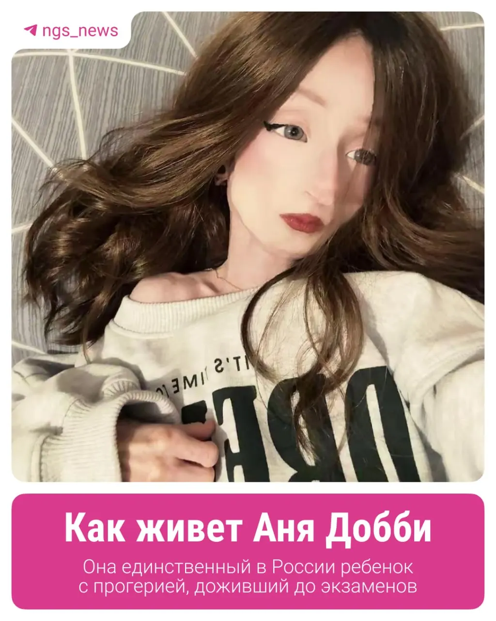Ане почти 17 лет. Несмотря на редкое генетическое заболевание, она ведёт обычную подростковую жизнь. Семья ожидает участия в клиническом испытании в США и добивается получения школьного аттестата.