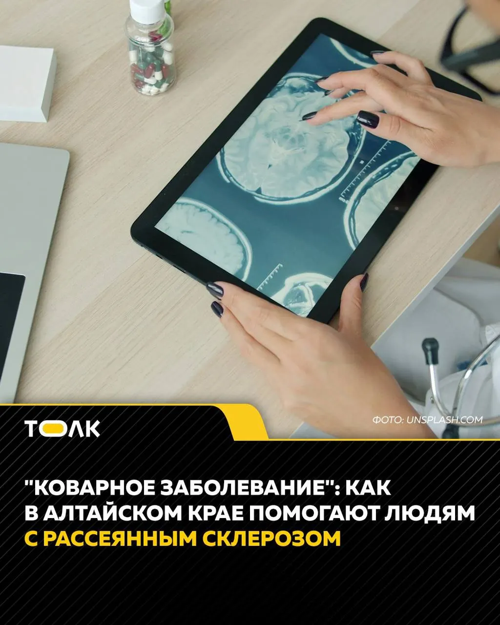 Заболевание чаще проявляется у людей 20–40 лет и даёт самые разные неврологические симптомы. В Алтайском крае при краевой больнице действует Школа рассеянного склероза для пациентов и их близких.