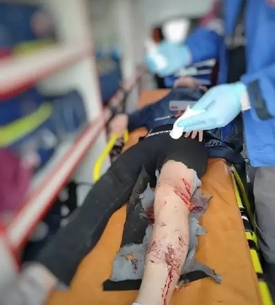 Прокуратура начала проверку после нападения стаи собак на двух мальчиков в районе мемориалов горы Шмидта: один подросток получил серьёзные травмы, пострадавшим оказали помощь и доставили в больницу.