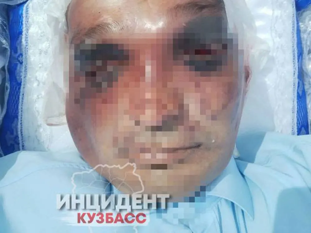 В Крапивинском округе 17‑летнего юношу обвиняют в нанесении смертельных травм: родственники потерпевшего сообщают, что мужчину били головой о бетон и наступали ногами.