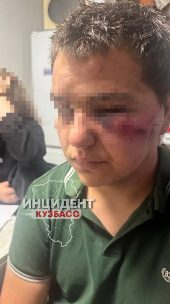 Подросток частично оглох и ослеп после избиения толпой в Новокузнецке; близкие утверждают, что он заступился за девушку, но стал мишенью злоумышленников и над ним издевались несколько часов.