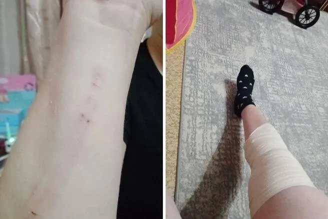 Пассажирка упала из-за резкого торможения водителя, получила ушиб колена; уточняются обстоятельства инцидента и результаты проверки.