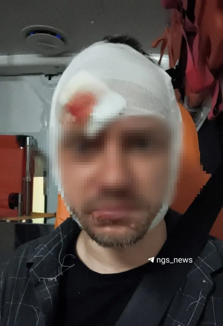 Ночью 23 августа около 4 часов утра возле мэрии Новосибирска мужчина пострадал после конфликта; полиция изучает записи камер, восстановление займёт около полутора месяцев.
